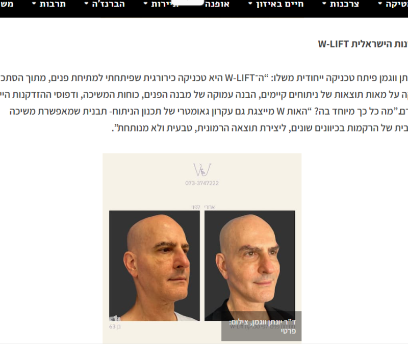 אבי ונציה W-LIFT