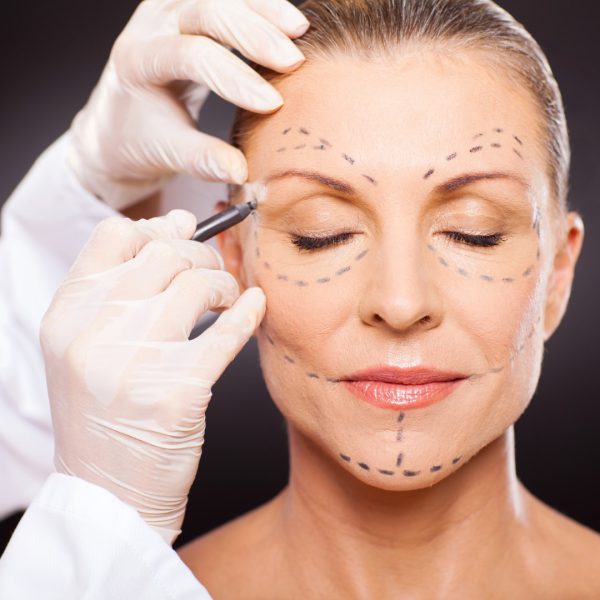 middle aged woman with correction marks preparing for plastic surgery